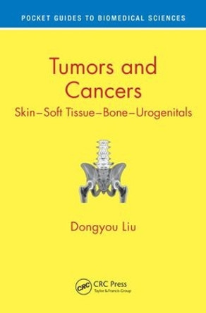 Tumors and Cancers: Skin - Soft Tissue - Bone - Urogenitals by Dongyou Liu 9781498729772