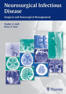 Neurosurgical Infectious Disease: Surgical and Nonsurgical Management Walter A. Hall 9781604068054