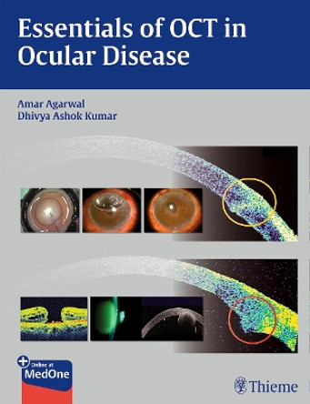 Essentials of OCT in Ocular Disease Amar Agarwal 9781626230989