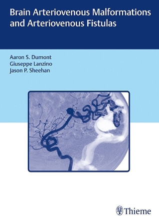 Brain Arteriovenous Malformations and Arteriovenous Fistulas by Aaron S. Dumont 9781626233225