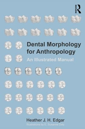 Dental Morphology for Anthropology: An Illustrated Manual by Heather J. H. Edgar 9781629585123