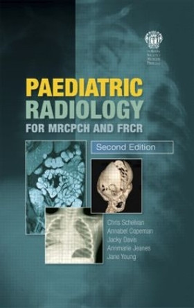 Paediatric Radiology for MRCPCH and FRCR, Second Edition by Christopher Schelvan 9781853157028