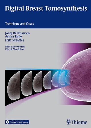 Digital Breast Tomosynthesis: Technique and Cases by Joerg Barkhausen 9783132031616