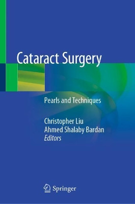 Cataract Surgery: Pearls and Techniques Christopher Liu 9783030382339