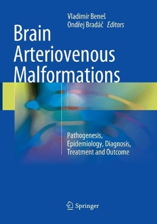 Brain Arteriovenous Malformations: Pathogenesis, Epidemiology, Diagnosis, Treatment and Outcome by Vladimir Benes 9783319876832