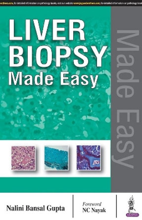 Liver Biopsy Made Easy by Nalini Bansal Gupta 9789386150264