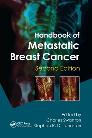 Handbook of Metastatic Breast Cancer by Charles Swanton 9780367382186