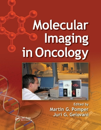 Molecular Imaging in Oncology by Martin G. Pomper 9780367403485