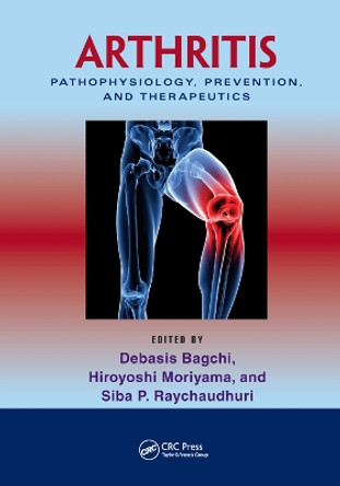 Arthritis: Pathophysiology, Prevention, and Therapeutics by Debasis Bagchi 9780367382872