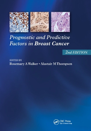 Prognostic and Predictive Factors in Breast Cancer by Rosemary A. Walker 9780367386931