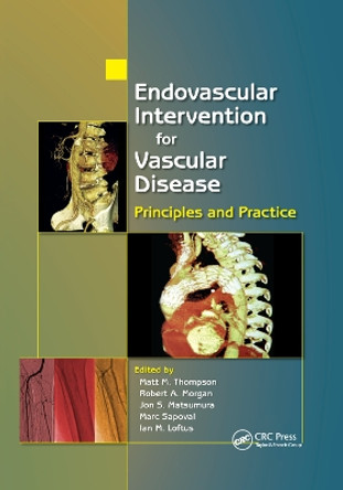 Endovascular Intervention for Vascular Disease: Principles and Practice by Matt M. Thompson 9780367387907