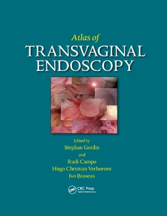 Atlas of Transvaginal Endoscopy by Stephan Gordts 9780367389543