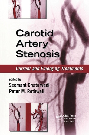 Carotid Artery Stenosis: Current and Emerging Treatments by Seemant Chaturvedi 9780367392406