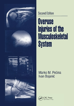 Overuse Injuries of the Musculoskeletal System by Marko M. Pecina 9780367446680