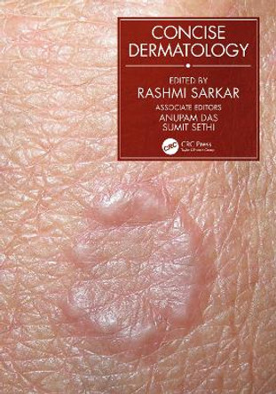 Concise Dermatology by Rashmi Sarkar 9780367533625