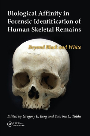 Biological Affinity in Forensic Identification of Human Skeletal Remains: Beyond Black and White by Gregory E. Berg 9780367778460