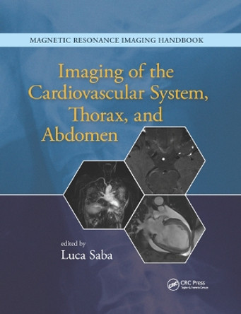Imaging of the Cardiovascular System, Thorax, and Abdomen by Luca Saba 9780367868918