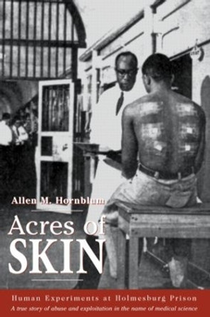 Acres of Skin: Human Experiments at Holmesburg Prison by Allen M. Hornblum 9780415923361