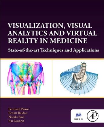 Visualization, Visual Analytics and Virtual Reality in Medicine: State-of-the-art Techniques and Applications by Bernhard Preim 9780128229620