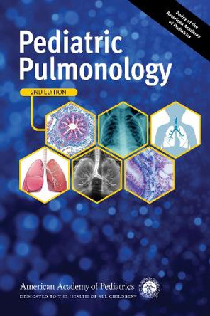 Pediatric Pulmonology by Michael J. Light 9781610026529