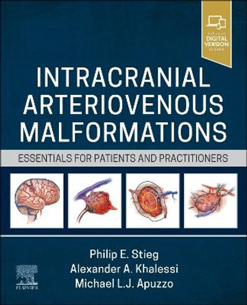 Intracranial Arteriovenous Malformations: Essentials for Patients and Practitioners by Philip E. Stieg 9780323825306