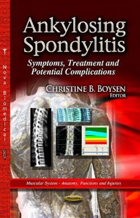 Ankylosing Spondylitis: Symptoms, Treatment & Potential Complications by Christine B. Boysen 9781626183612