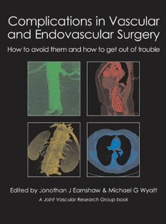 Complications in Vascular & Endovascular Surgery: How to Avoid Them & How to Get Out of Trouble by Jonothan J. Earnshaw 9781903378809