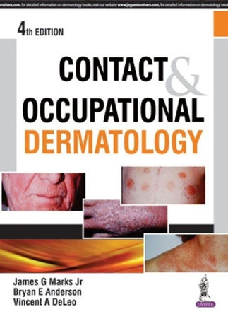 Contact & Occupational Dermatology by James G Marks Jr 9789351529361