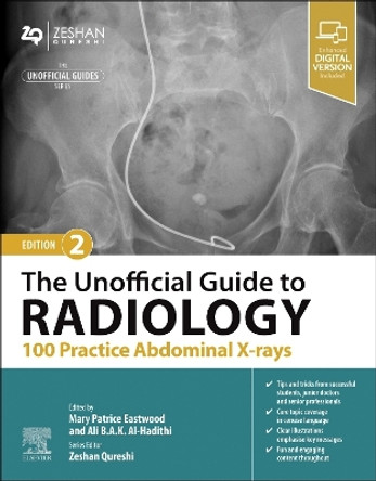 The Unofficial Guide to Radiology: 100 Practice Abdominal X-rays by Patrice Eastwood 9780443109188