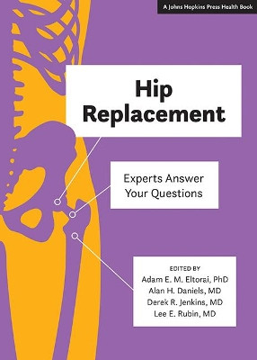 Hip Replacement: Experts Answer Your Questions Adam E. M. Eltorai 9781421429588