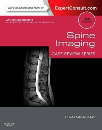 Spine Imaging: Case Review Series: Expert Consult - Online and Print by Efrat Saraf-Lavi 9781455751167