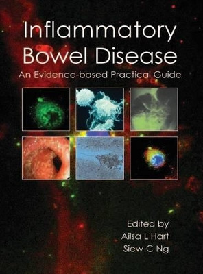 Inflammatory Bowel Disease: An Evidence-Based Practical Guide by Alisa L. Hart 9781903378823