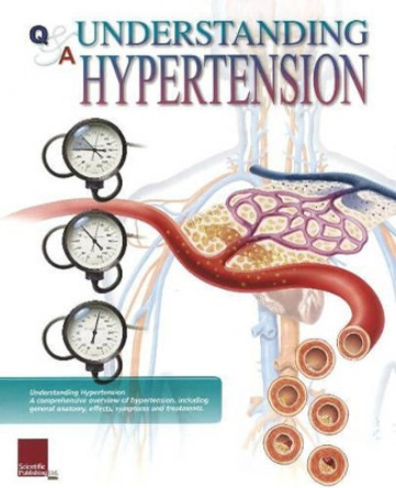 Understanding Hypertension Flip Chart by Scientific Publishing 9781932922301