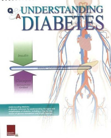 Understanding Diabetes Flip Chart by Scientific Publishing 9781932922325