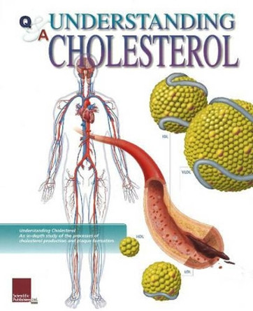 Understanding Cholesterol Flip Chart by Scientific Publishing 9781932922332