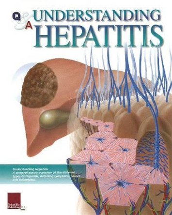 Understanding Hepatitis Flip Chart by Scientific Publishing 9781932922349