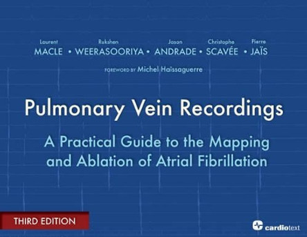 Pulmonary Vein Recordings: A Practical Guide to the Mapping and Ablation of Atrial Fibrillation by Laurent Macle 9781935395041