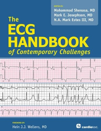 ECG Handbook of Contemporary Challenges by Mohammad Shenasa 9781935395881