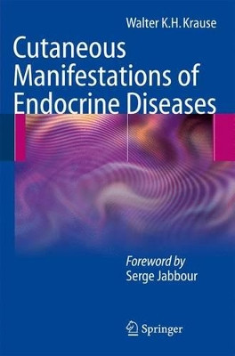 Cutaneous Manifestations of Endocrine Diseases by Walter K. H. Krause 9783642100024