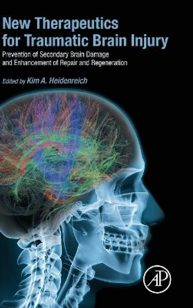 New Therapeutics for Traumatic Brain Injury: Prevention of Secondary Brain Damage and Enhancement of Repair and Regeneration by Kim Heidenreich 9780128026861