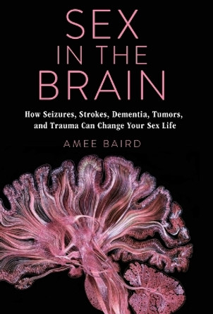 Sex in the Brain: How Seizures, Strokes, Dementia, Tumors, and Trauma Can Change Your Sex Life by Amee Baird 9780231195904