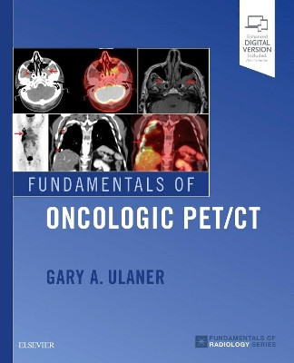 Fundamentals of Oncologic PET/CT by Gary A. Ulaner 9780323568692