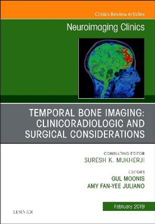 Temporal Bone Imaging: Clinicoradiologic and Surgical Considerations, An Issue of Neuroimaging Clinics of North America by Gul Moonis 9780323654777