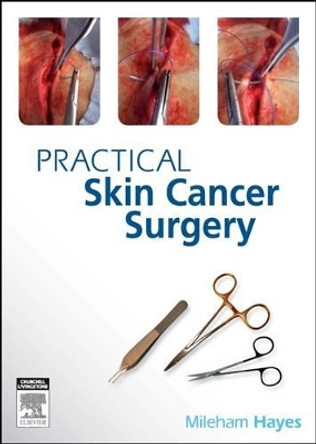 PRACTICAL SKIN CANCER SURGERY by Anthony Dixon 9780729539326