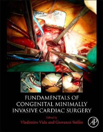 Fundamentals of Congenital Minimally Invasive Cardiac Surgery by Vida 9780128113554