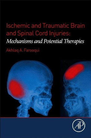 Ischemic and Traumatic Brain and Spinal Cord Injuries: Mechanisms and Potential Therapies by Akhlaq A. Farooqui 9780128135969