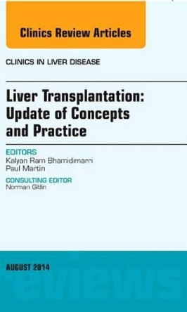 Liver Transplantation: Update of Concepts and Practice, An Issue of Clinics in Liver Disease by Kalyan Ram Bhamidimarri 9780323320160