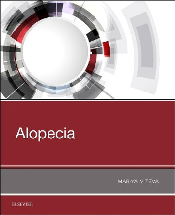 Alopecia by Mariya I Miteva 9780323548250