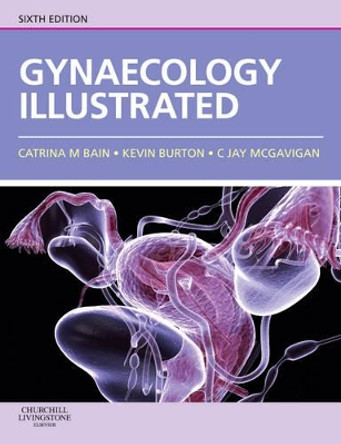 Gynaecology Illustrated by Catrina Bain 9780702030673