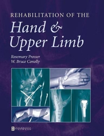 Rehabilitation of the Hand and Upper Limb by W.Bruce Conolly 9780750622639